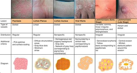 Medical Terms For Skin Diseases at Harry Oloughlin blog