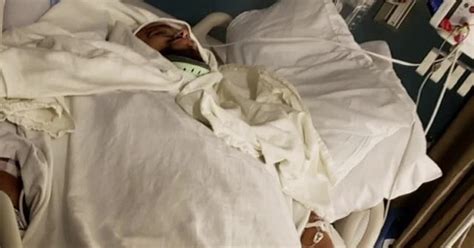 Dallas man who lost leg after being hit by alleged drunk driver ...