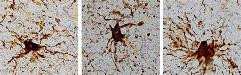 'Zombie' genes? Research shows some genes come to life in the brain ...