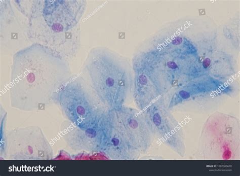 Squamous Epithelial Cells Under Microscope