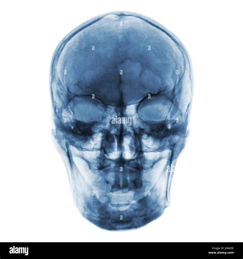 Human skull front view hi-res stock photography and images - Alamy