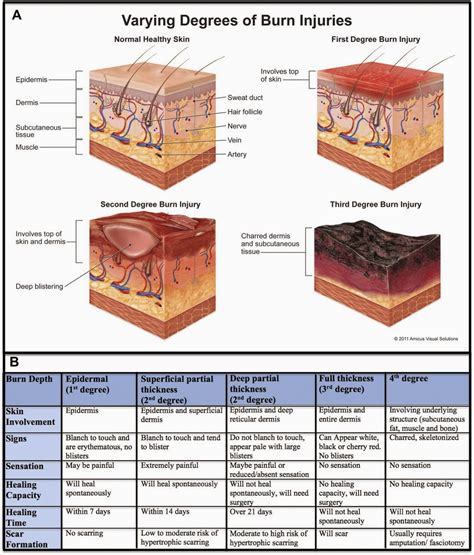 Fourth Degree Burn Diagram