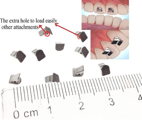 10 Pcs SmileTech New Bite Turbos Dental Orthodontic Materials | Buy Now ...