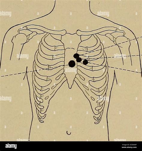 Cardiac Apex High Resolution Stock Photography and Images - Alamy