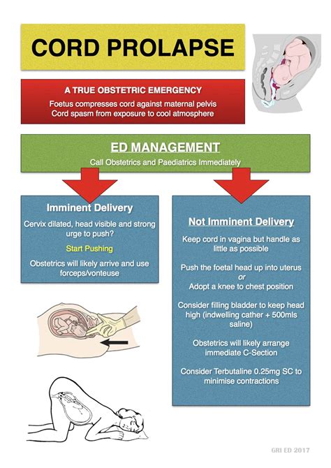 Prolapsed Cord CORD PRESENTATION AND PROLAPSE – Nursing Powerpoint