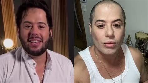 Hugo, dupla de Tiago, explica aparência em foto, nega harmonização facial e exibe verdadeiro ...