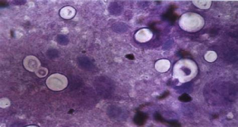 Image result for encapsulated