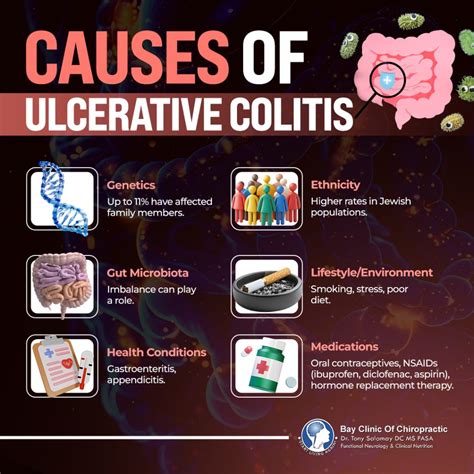 Ulcerative Colitis Causes Inflammatory Bowel Disease (IBD): Causes,