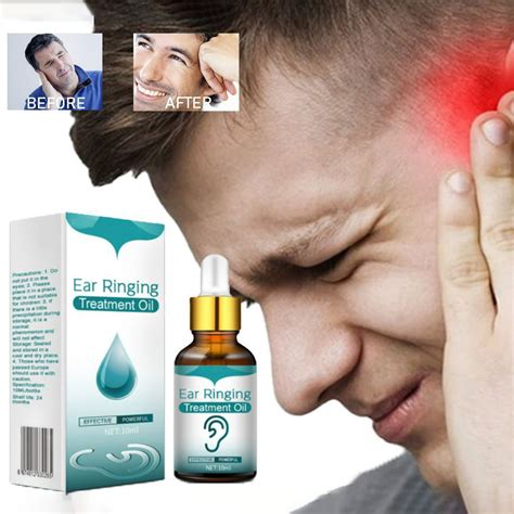 Tinnitus Ear Drops To Tinnitus Ear Itching Ear Pain, Ear Cleaning Earwax Dry Hard Ear Drops10ML ...