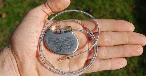Knowing the heart’s intricate electrical system explains how pacemakers ...