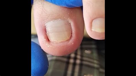 Image result for Clean Toe Nails