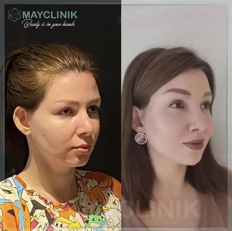 Image result for Map Method. JavaScript