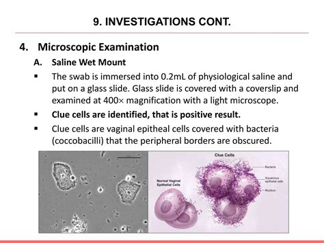 Bacterial Vaginosis.pptx