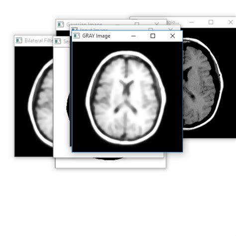 Image result for Tumor Segmentation Using Python