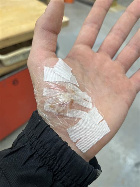 15, coughing up and finding black specks in mucus : r/medical