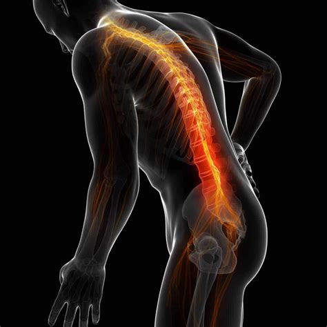 Lower Back Muscle Spasm 的图像结果