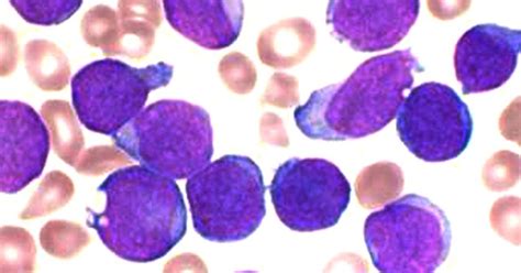 Scientists claim 'extraordinary' success with treatment using immune ...