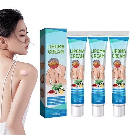 Herbal Lipoma Removal Cream, Fatty Lumps Remover, Sri Lanka | Ubuy