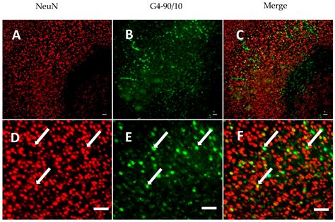 PAMAM Dendrimers Cross the Blood–Brain Barrier When Administered ...