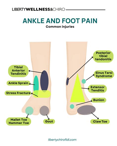 Ankle & Foot Pain Treatments, NYC - Liberty Wellness & Chiro
