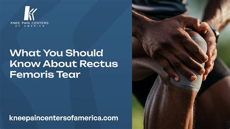 What You Should Know About Rectus Femoris Tear