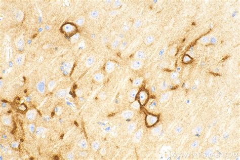 Aggrecan antibody (13880-1-AP) | Proteintech