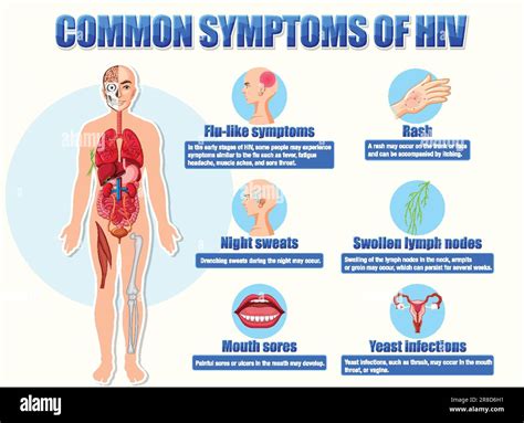Groin Lymph Nodes Hiv