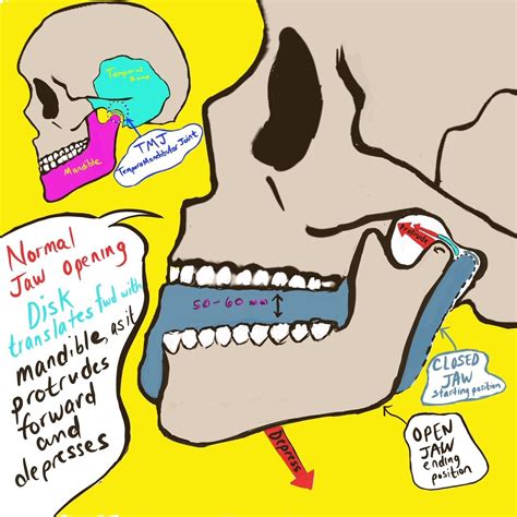 Why Is The Inside Of My Jaw Hurting at Elisa Champagne blog