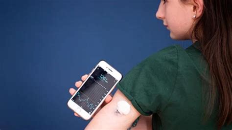 Continuous glucose monitors (CGM): Should non-diabetics wear them ...
