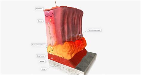 Premium Photo | Full thickness wound in skin tissue