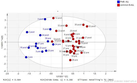 Metabolic Fingerprint in Childhood Acute Lymphoblastic Leukemia