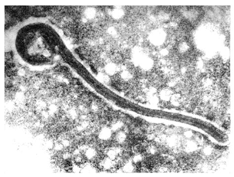 Forty-Five Years of Marburg Virus Research
