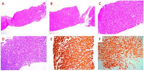 JPM | Special Issue : Biomarkers, Therapeutic Opportunities and Tumor ...