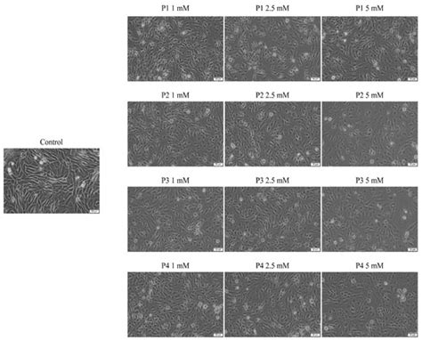 The Biological Impact of Some Phosphonic and Phosphinic Acid ...