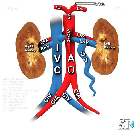 What Is Renal Nutcracker Syndrome at Cynthia Gilliland blog