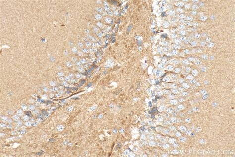 SCN8A antibody (28504-1-AP) | Proteintech
