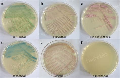 感染念珠菌的九种症状和三种调理方法_传染病知识_上海凯创生物技术有限公司