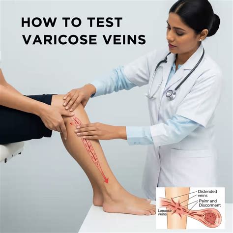 How to Test for Varicose Veins? – healthcare nt sickcare