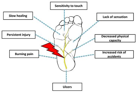 Diabetic Peripheral Neuropathy