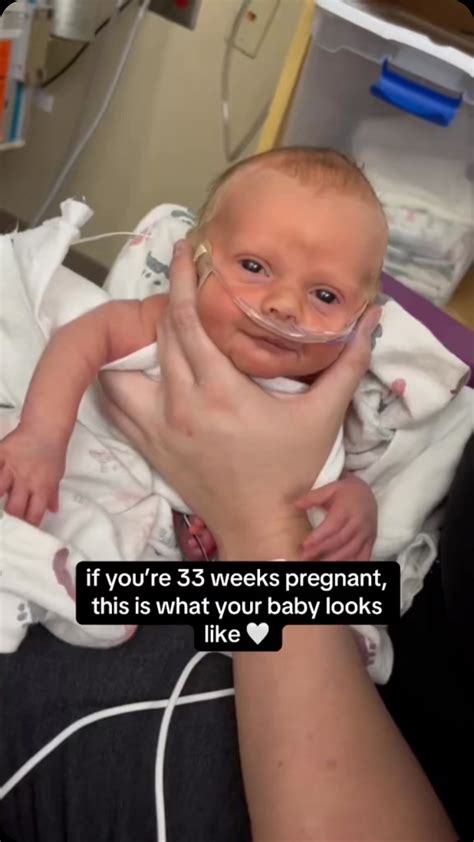Our Little Preemie ®️ | If you’re 33 weeks pregnant this is what your ...