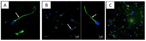 Zika RNA and Flavivirus-Like Antigens in the Sperm Cells of Symptomatic ...