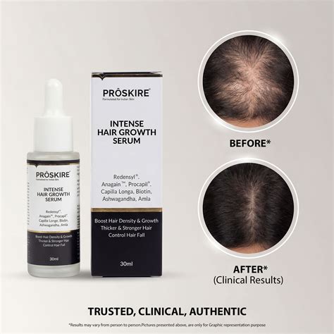 Hair Growth Serum 30ml – Proskire