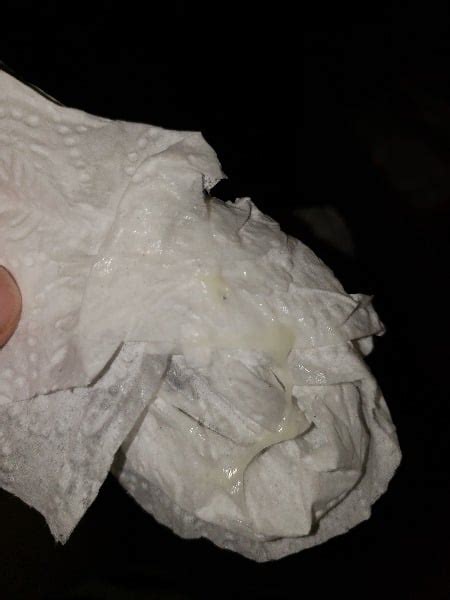 Sti yellow discharge. Comprehensive Guide to Common STIs: Symptoms ...