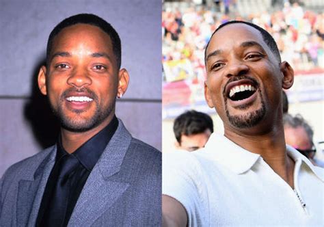 How To Use Rice Water For Hair Growth On Bald Patches For Men In Their 30s?