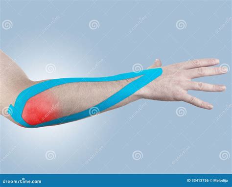 Kinesio Tex Tape Therapeutic Treatment of the Elbow Stock Photo - Image ...