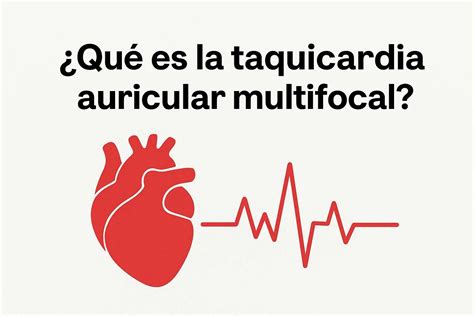 Taquicardia Auricular Multifocal vs Monofocal: Diagnóstico y Tratamiento