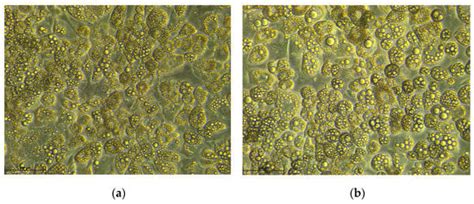 Fatty Acids as Potent Modulators of Autophagy Activity in White Adipose ...