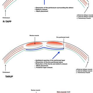 What Is AWR Structure 的图像结果