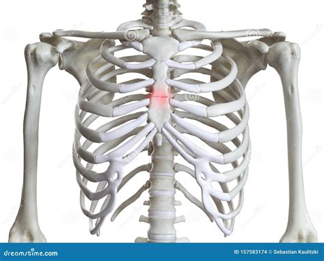 What Does Pain In The Breast Bone Mean at Caitlin Sandra blog