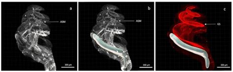 Evaluation of the Efficacy of Dexamethasone-Eluting Electrode Array on ...